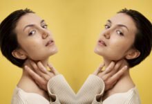 smokers lines filler before and after