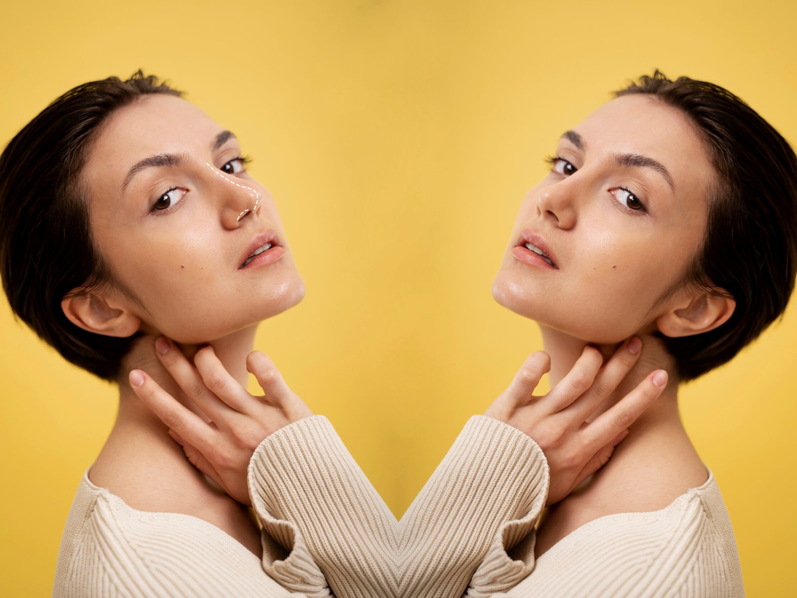 smokers lines filler before and after