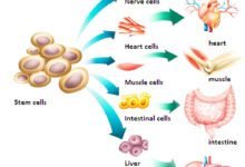 Stem Cell Therapy