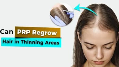PRP regrow