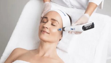 microneedling edmonton alberta