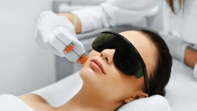 laser hair removal Edmonton
