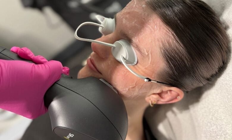 ipl skin rejuvenation Edmonton